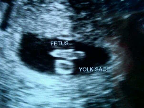 Pregnancy Week 6 – (Not So) Wordless Wednesday